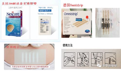 術(shù)后祛疤減張產(chǎn)品 減張器與減張貼相關(guān)問(wèn)題匯總解答